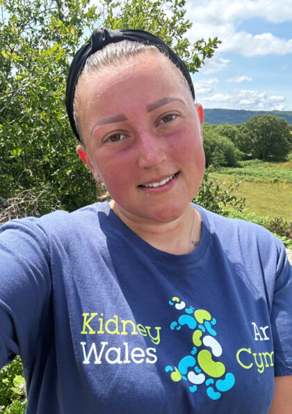 Meet Chloe: A #TeamKidney Wales Runner and Renal Nurse in the Making